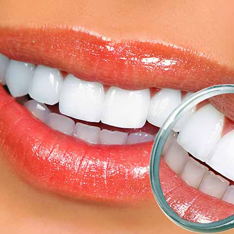 Фото відбілених зубів крупним планом і в стоматологічному дзеркалі